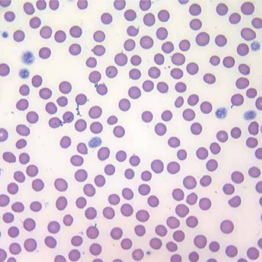 Anemia perniciosa nel cane